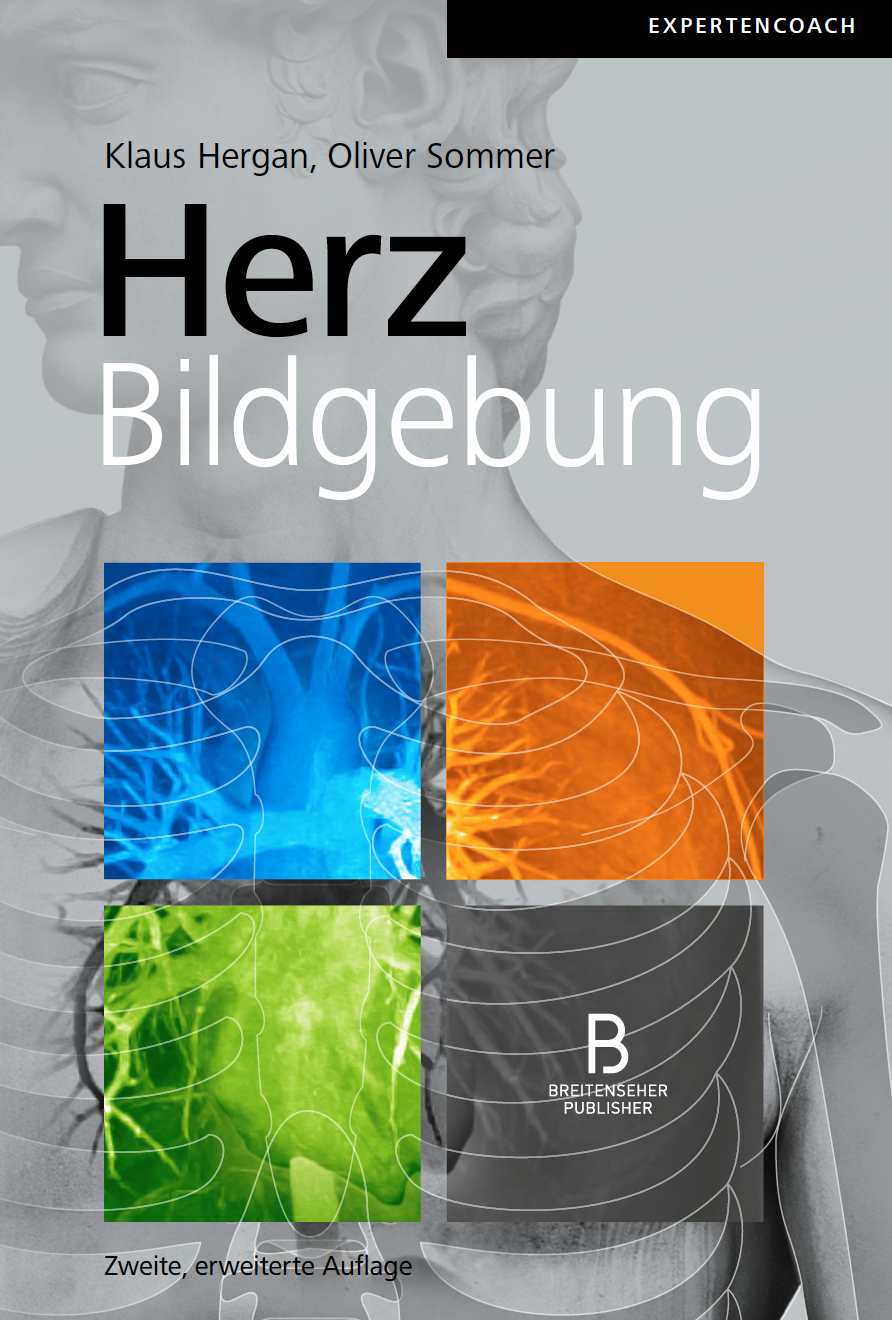 Herzbildgebung